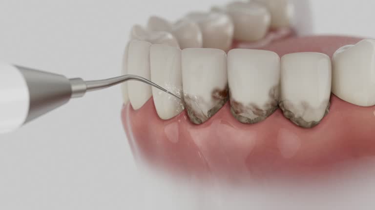 Reliable Dental Implants contractor in Pineville, KY by Smile Center Dentistry